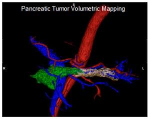 3D Oncologic Imaging